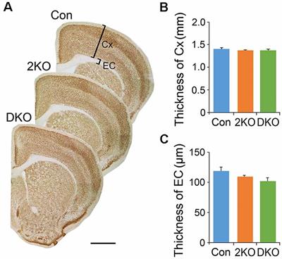 Deprivation of Muscleblind-Like Proteins Causes Deficits in Cortical Neuron Distribution and Morphological Changes in Dendritic Spines and Postsynaptic Densities